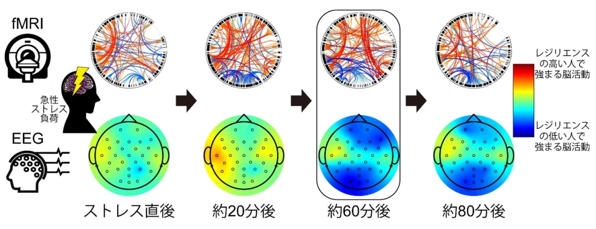 急性ストレス負荷後の脳活動の変化